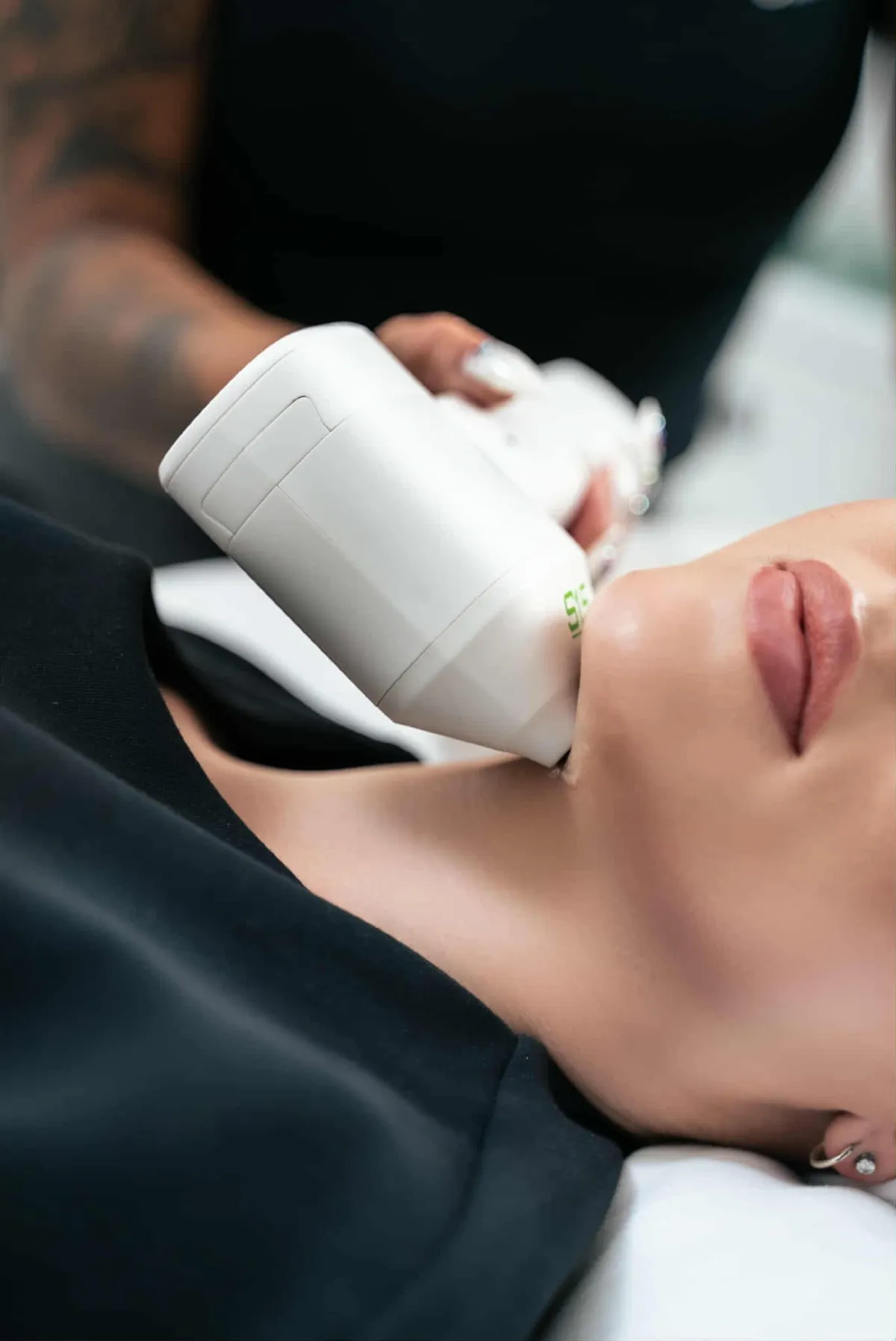 HIFU-behandling på käklinje och kinder hos Ageless Beauty by Patricia i Ängelholm